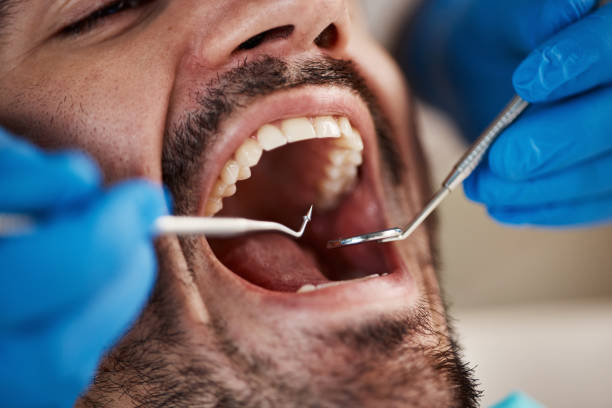 Best Emergency Dental Care for Broken or Chipped Teeth in Ore City, TX